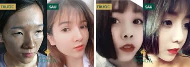 Xem tướng mũi Chuẩn để đoán vận mệnh Sang