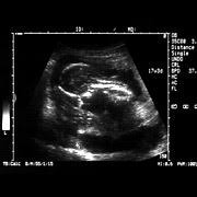 En février j'ai eu mes règles mais j'avais très peur car un jour de saignement puis rien pendant 3 jours avant de. Le Deni De Grossesse Chatelaine