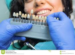 teeth whitening chart stock image image of difference