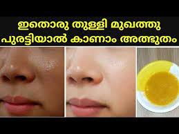 Pin On Face Care