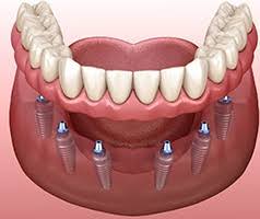 Image result for Multidentia exserta