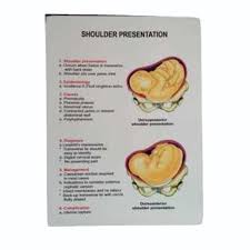 Image result for Shoulder Presentation