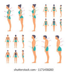 Correct Incorrect Posture Spine ...