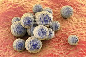 Die übertragung von mrsa erfolgt am häufigsten durch haut zu haut kontakt zwischen einzelnen personen. Bakterien Methicillin Resistenter Staphylococcus Aureus Mrsa Fototapete Fototapeten Durchfall Medicals Pathologie Myloview De