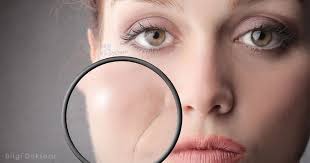 Eğer doğal yollarla klozeti temizlemek istiyorsanız, sizin için harika önerilerim var. Klozetteki Sari Leke Nasil Cikar Kokunden Cozumu Saglik Paylasimlari