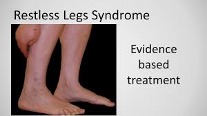 Image result for Restless Leg Syndrome