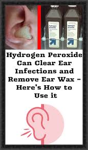 Hydrogen Peroxide Can Clear Ear Infections And Remove Ear Wax Here S How To Use It Ear Infection Ear Wax Hydrogen Peroxide Uses