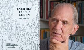 Over het hoofd gezien