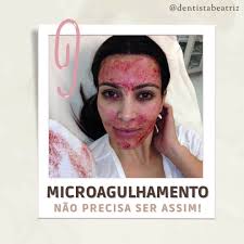 Certamente você já viu essa selfie que, há alguns anos atrás, ficou  famosíssima na internet. A Kim