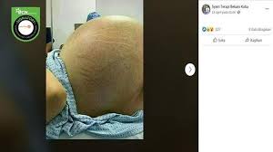 Kepada yang risau dihalang keluar dari negara akibat hutang semasa belajar ataupun bersalah mencerca kerajaan (boleh dihalang keluar negara selama tiga tahun), ini laman yang perlu disimpan di dalam senarai favourite pada pelayar web. Cek Fakta Hoaks 4 Hal Berbahaya Jika Dilakukan Saat Wanita Haid Cek Fakta Liputan6 Com