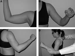 Image result for Shoulder Apprehension Test