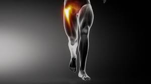 Pin On Hip Pain