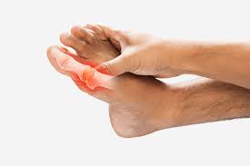 Inflammatory Arthritis Care | Alliance Orthopedics