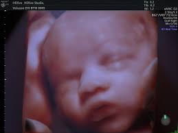 Alta definición y la tecnología más avanzada para el diagnóstico  ginecológico y prenatal