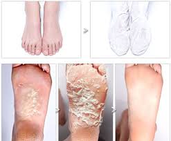 Baby Foot Peel Transformations Your Disgusting New Obsession Baby Feet Peel Foot Peel Peeling Mask