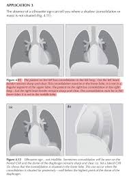 Image result for Silhouette Sign