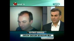 Oktay kaynarca saçının peruk olmadığını kanıtladı. Sac Ekimi Operasyon By Op Dr Zekeriya Kul