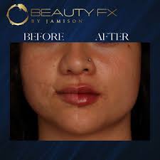 Jamison Williams, Aesthetic NP, CANS (@beautyfxbyjamison) • Instagram  photos and videos