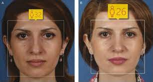 A Way To Look Younger Is Right Under Your Nose Ucla Led Study Finds Eurekalert Science News