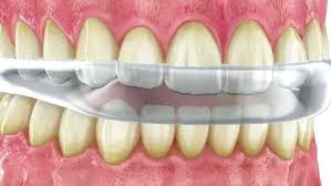 Cómo detectar que tu