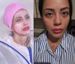 Jasmine's resilience