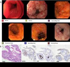 Luminal Clinical - 2024 - Journal of Gastroenterology and Hepatology -  Wiley Online Library