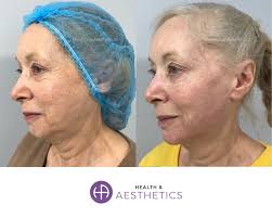 Who is Dr Rekha Tailor?