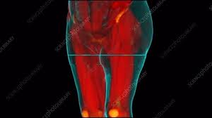 Find the perfect female muscle diagram stock illustrations from getty images. Female Hip Muscle Anatomy Stock Video Clip K007 7419 Science Photo Library