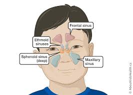 Check spelling or type a new query. Sinus Infections