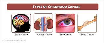 № 2 подставьте необходимое слово в предложение. Childhood Cancer Types Causes Symptoms Diagnosis Complication Prevention