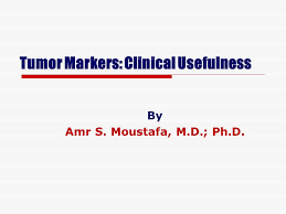 On this page can tumor markers be used in cancer screening? What Do Tumor Markers Tell You