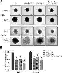 Lithium chloride (licl) has been shown to demonstrate anticancer properties at supratherapeutic doses. Combined Application Of Arsenic Trioxide And Lithium Chloride Augments Viability Reduction And Apoptosis Induction In Human Rhabdomyosarcoma Cell Lines