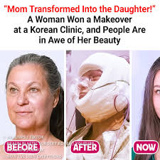 An ordinary 57-year-old woman won a series of plastic surgeries completely  for free. A video documenting her experience went viral