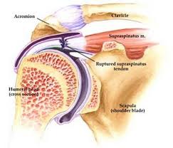 The joints between these bones are flexible and allow for a wide range of motion. What Is The Supraspinatus Tendon Ehow Rotator Cuff Supraspinatus Muscle Shoulder Anatomy
