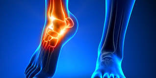 The achilles tendon is the largest tendon in the body. 5 Facts From Surgeons For Achilles Pain Tendonitis Rothman Orthopaedic Institute
