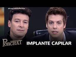 Quisiéramos ante todo aclarar que, este tratamiento quirúrgico, en los pacientes tiene varios nombres, o es conocido de diferentes maneras y es importante aclarar que no hay ninguna diferencia entre todos esos. Rodrigo Faro Analisa Sugestoes Para Implante Capilar Youtube