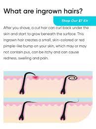 Wax at home like a pro. Lashay S Faces Benefits Of Waxing Vs Shaving Ingrown Facebook