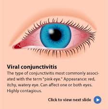 Pink Eye Conjunctivitis Symptoms Causes And Treatments Pink Eyes School Nurse Office Eye Facts