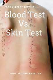 Pin On Skin Problems