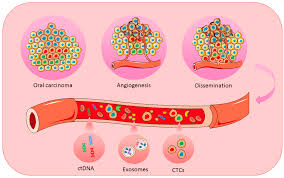 The concentration must be sufficient to ensure correct fixation of the tissue. Ijms Free Full Text Liquid Biopsy In Oral Cancer