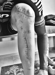 For us the tour de france is just some really long bicycle ride that we could care less about, but the rest of the planet really loves it. Tour De France Polish Cyclist Pawel Poljanski Shows Off The Veins In His Legs After 16 Days On The Bike