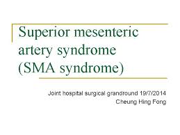 Superior Mesenteric Artery Syndrome Sma Syndrome Joint Hospital