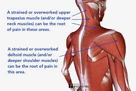 The clavicle is the only bony attachment between the trunk and the upper limb. Understanding Shoulder Pain Neuromuscular Therapy Of Vermont