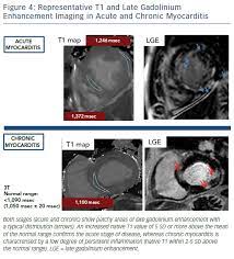 This article aims to frame a general. Advances In Cardiovascular Mri Using Quantitative Tissue Characterisation Techniques Focus On Myocarditis Ecr Journal
