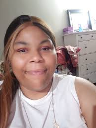 Why are tape marks appearing