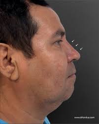 Dr David Lurduy Cirugía Plástica