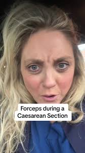 Forceps & Caesarean: What You Need to Know