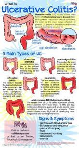 Uc Ulcerative Colitis Gastrointestinal Nursing Ulcerative Colitis Ulcers