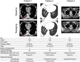 The pancreas is located behind the stomach, so having pancreatic cancer doesn't involve a palpable mass that you can feel. Local Delivery Of Car T Cells Targeting Fibroblast Activation Protein Is Safe In Patients With Pleural Mesothelioma First Report Of Fapme A Phase I Clinical Trial Annals Of Oncology