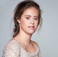 Down syndrome or down's syndrome, also known as trisomy 21, is a genetic disorder caused by the presence of all or part of a third copy of chromosome 21. A Model With Down Syndrome Proves You Re The Only One Who Can Define Beauty For